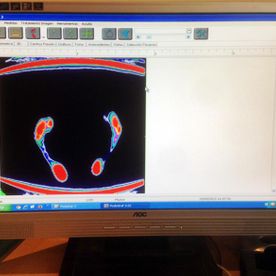 Podocenter monitor con resultados